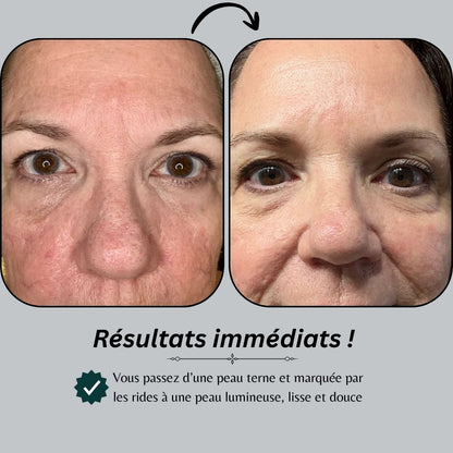 Le système de micro-infusion