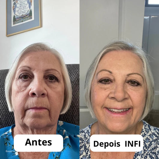 Micro-Infusão Lift Pro