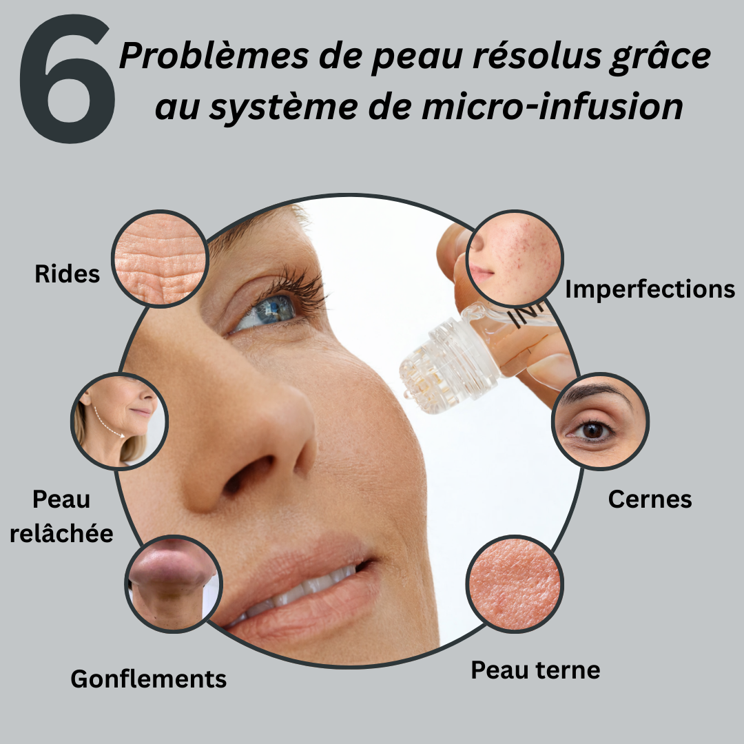 Le système de micro-infusion